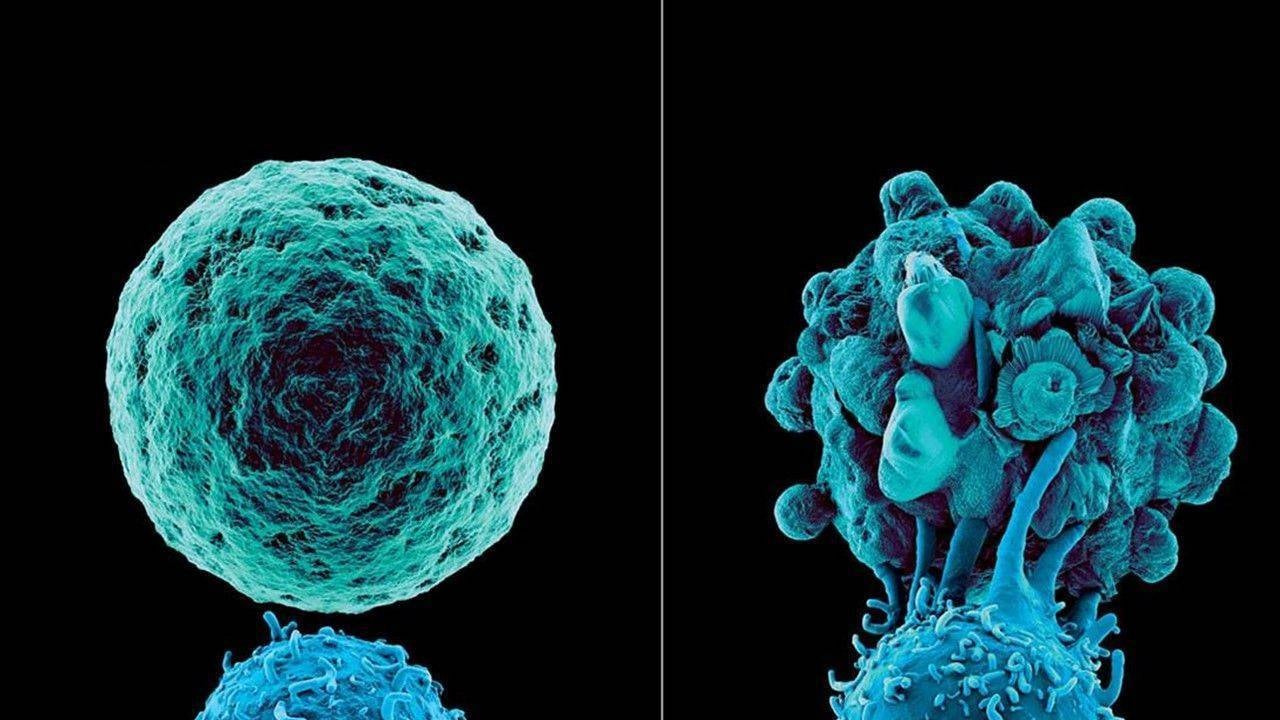 Foto - Doğal, hızlı iyileşme rehberi: Evde uçuk tedavisi! Uçuk nedir? Uçuk belirtileri nelerdir? 