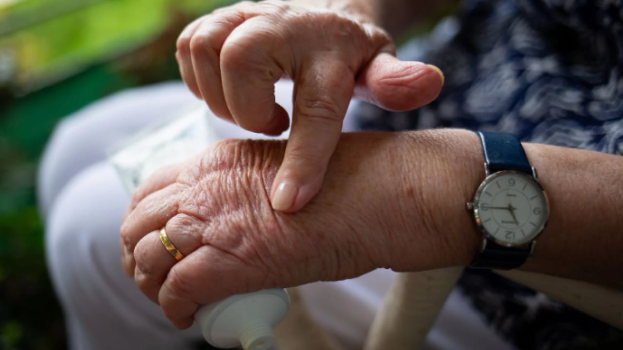 Foto - Deneyince farkını göreceksiniz! Kuruyan ellere doğal nem kazandıran yöntem