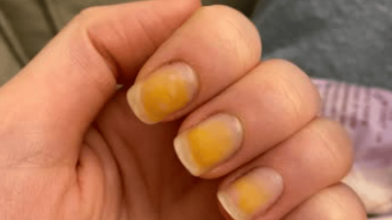 Deneyince farkını göreceksiniz! Sararan tırnakları beyazlatmanın doğal yolu