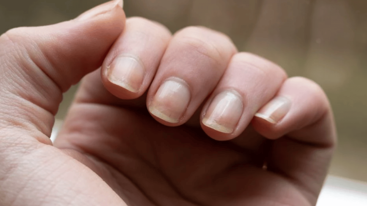 Foto - Deneyince farkını göreceksiniz! Sararan tırnakları beyazlatmanın doğal yolu