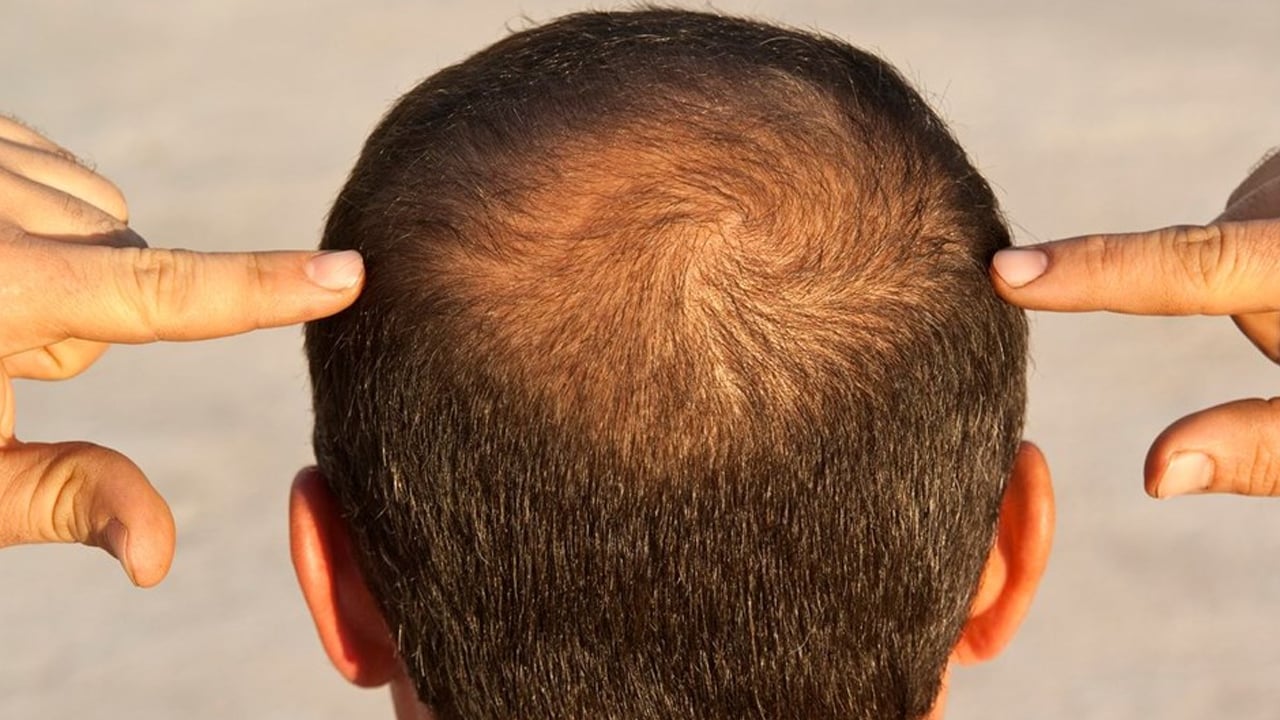 Foto - Sıcak suyla duş almak saçlarınızı etkiler! Dermatologlar net konuştu: Bunu yaparsanız saç dökülmesi yaşanacak