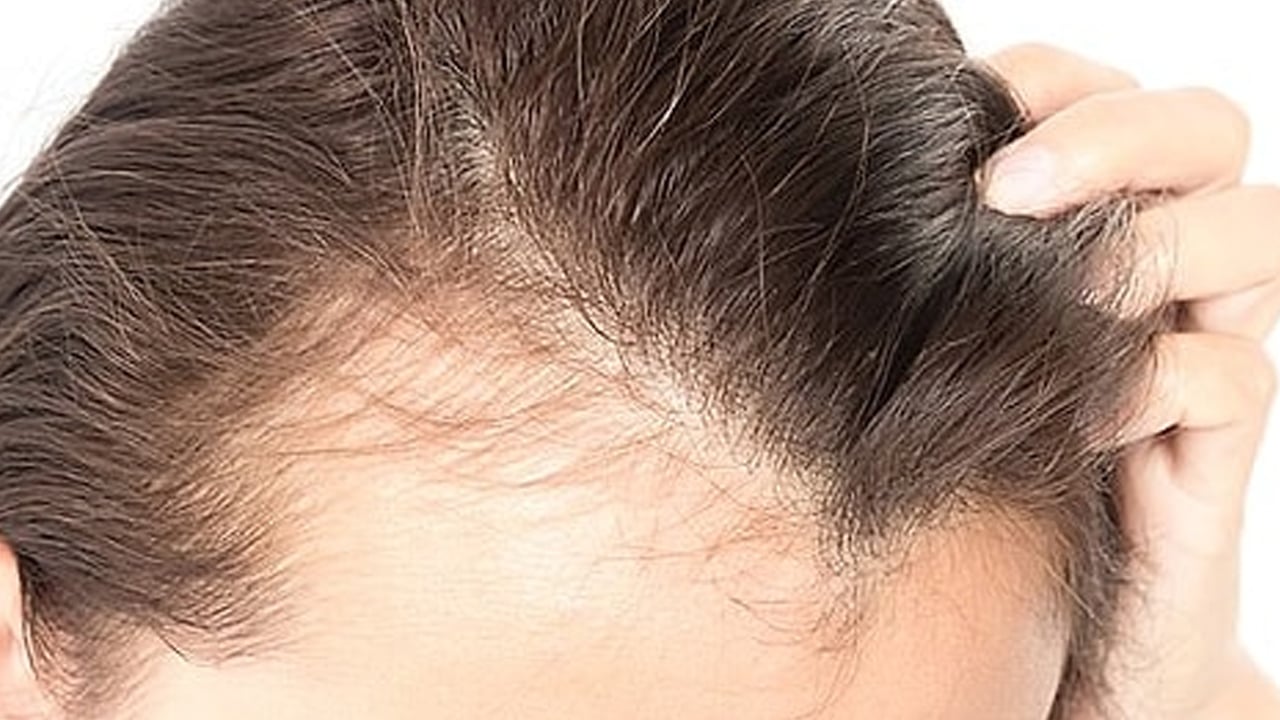 Sıcak suyla duş almak saçlarınızı etkiler! Dermatologlar net konuştu: Bunu yaparsanız saç dökülmesi yaşanacak