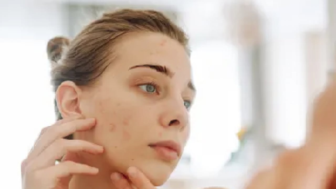 Foto - Dermatologlar tek bir seste birleşiyor: Cildinizdeki sivilcelerin gizli sebebi banyonuzda saklı!