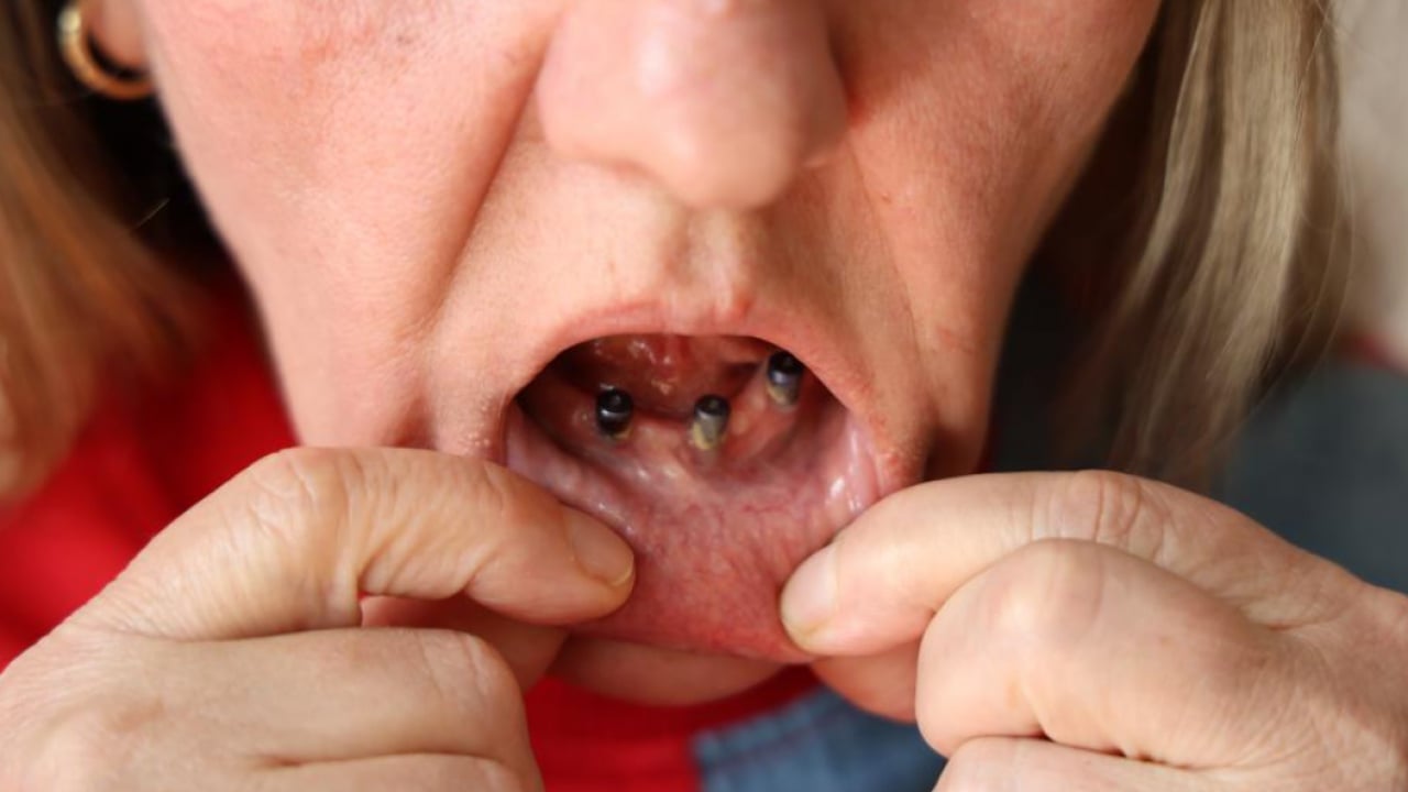 Foto - Diş ağrısı diye gitti, hayatının şokunu yaşadı