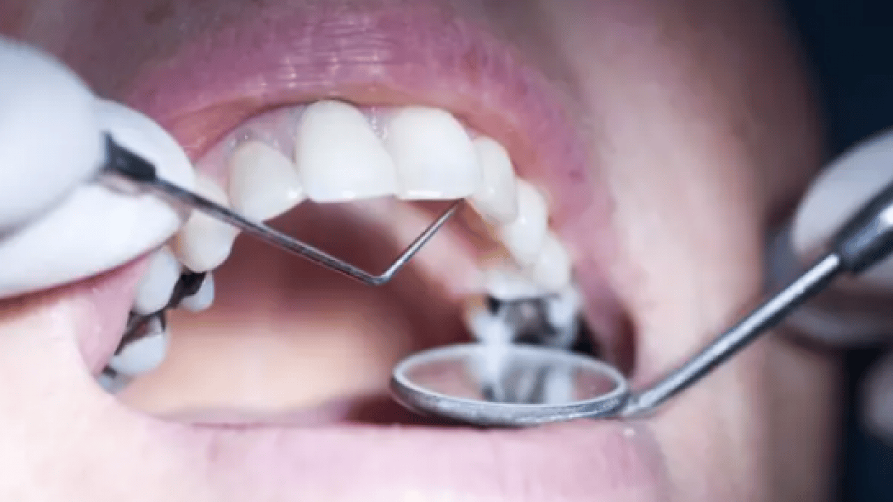 Foto - Dişçi karı koca hakim karşısında! İçeceğine alkol karıştırıp kabusu yaşattılar: Genç kadın dehşeti anlattı