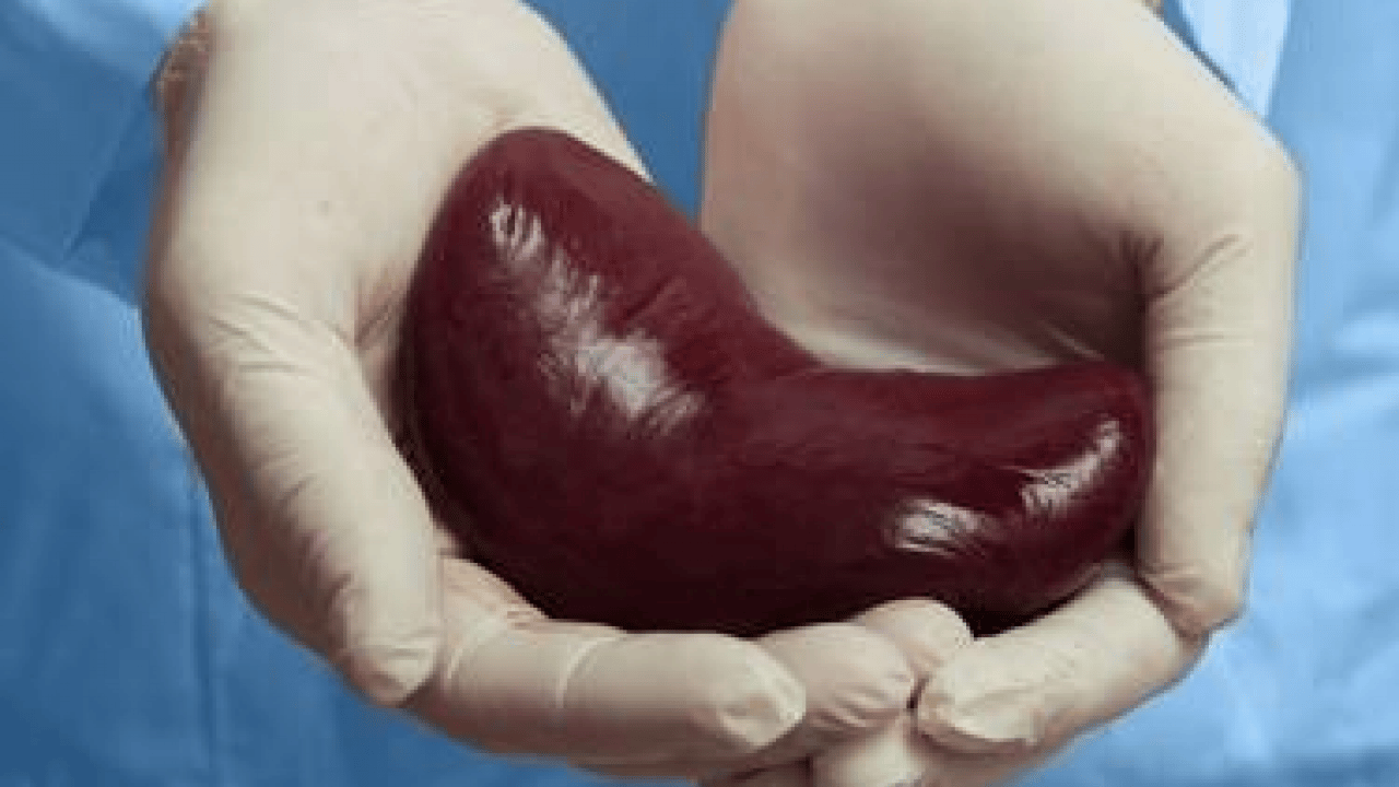 Diyabet, obezite ve hipertansiyon en önemli risk faktörleri arasında: Dünyada 850 milyon kişi böbrek hastalığı...