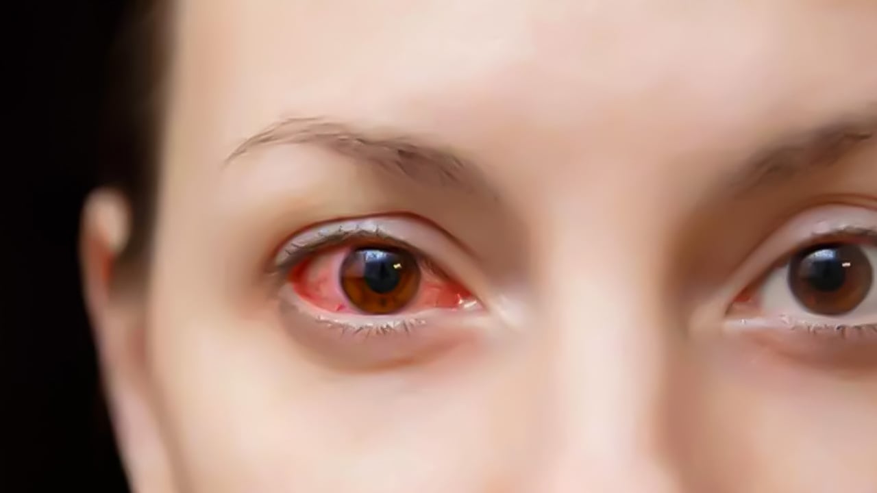 Foto - Diyabet sessizce tehdit ediyor: Hastalığa karşı günde en az 30 dakika yürüyün! Gizli şekerden korunmanın faydaları