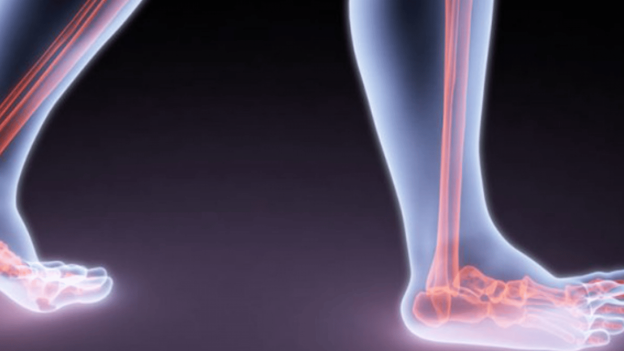 Foto - Diyabet, stres, dolaşım ve daha neler neler... Ayaklarda uyuşma neden olur?