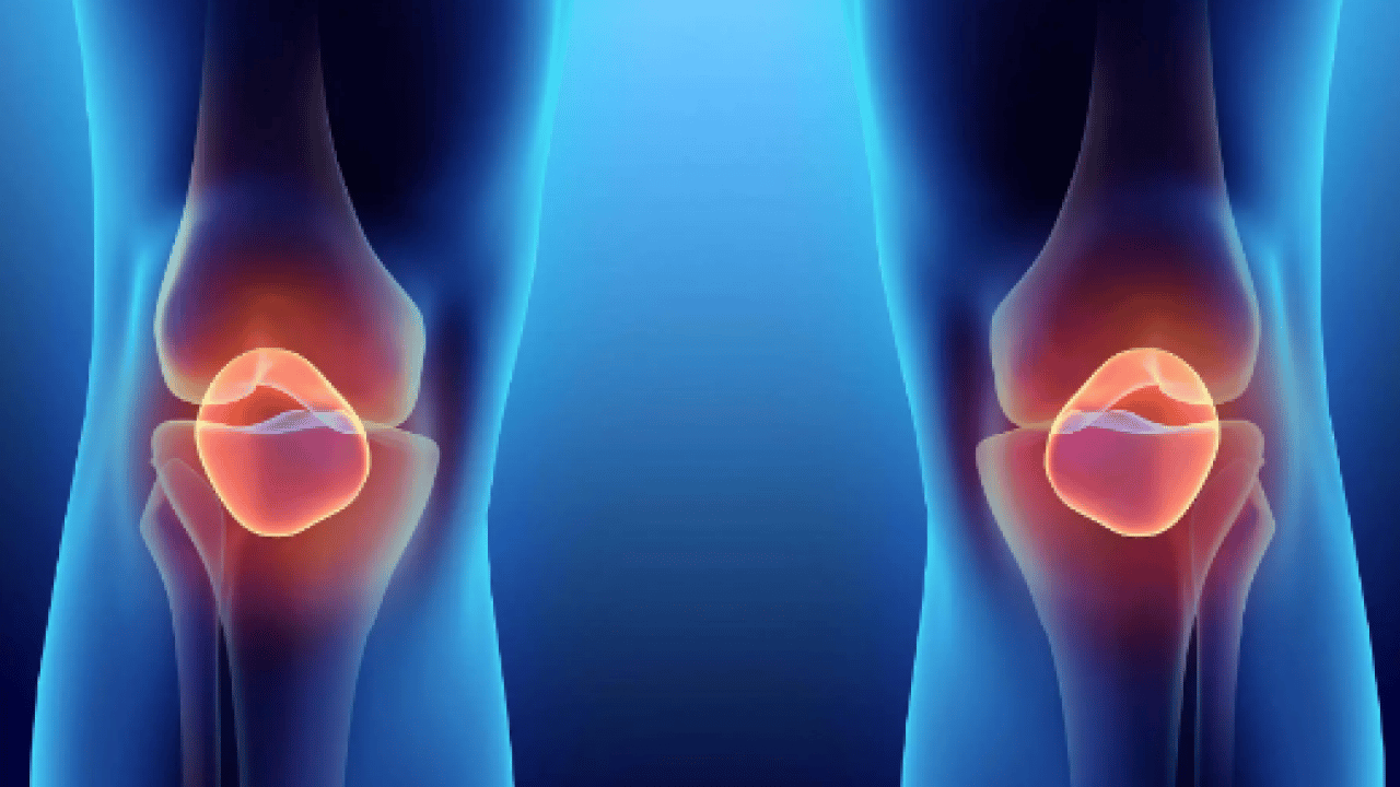 İlaç çözüm değil! Dizde ağrı, kilitlenme ve takılma... Bu belirtiler varsa spordan uzak durun uyarısı!