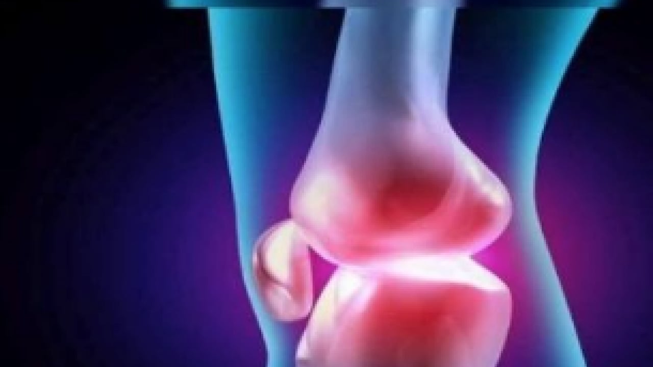 Foto - İlaç çözüm değil! Dizde ağrı, kilitlenme ve takılma... Bu belirtiler varsa spordan uzak durun uyarısı!