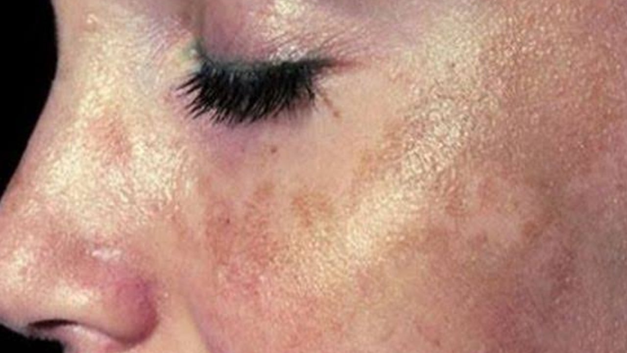 Foto - DNA hasarına karşı güneş kremi kullanın: Yaz aylarının vazgeçilmezi böyle koruyucu ve önleyici oluyor