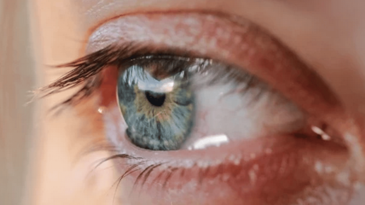 Doğal ağrı kesici: Herkes şimdi de merak ediyor.. Gözyaşı neden akar?