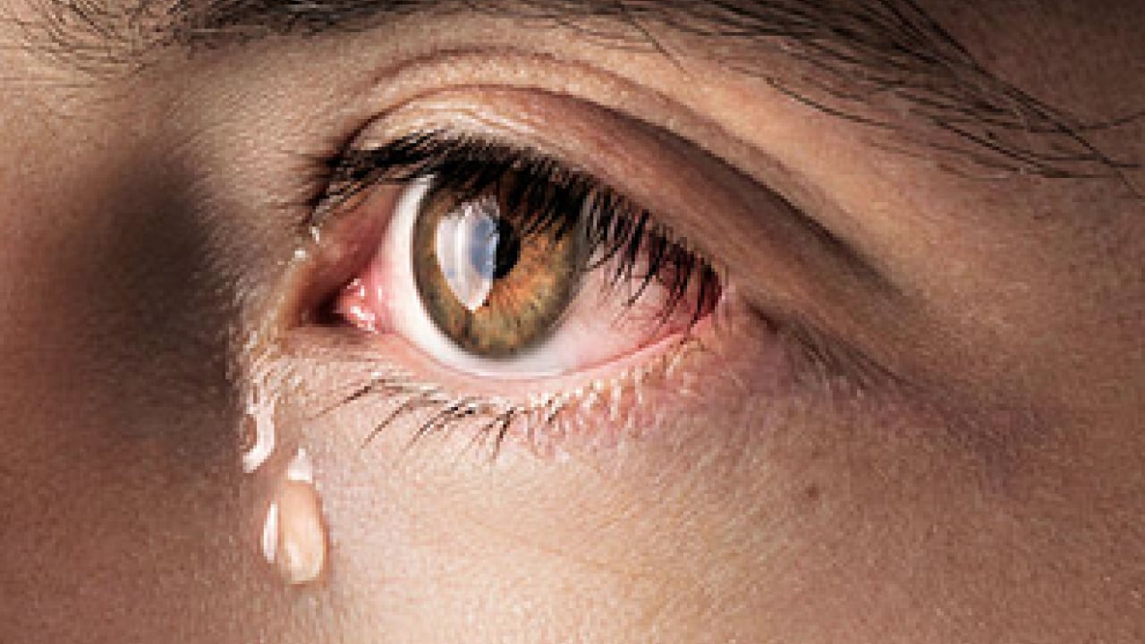 Foto - Doğal ağrı kesici: Herkes şimdi de merak ediyor.. Gözyaşı neden akar?