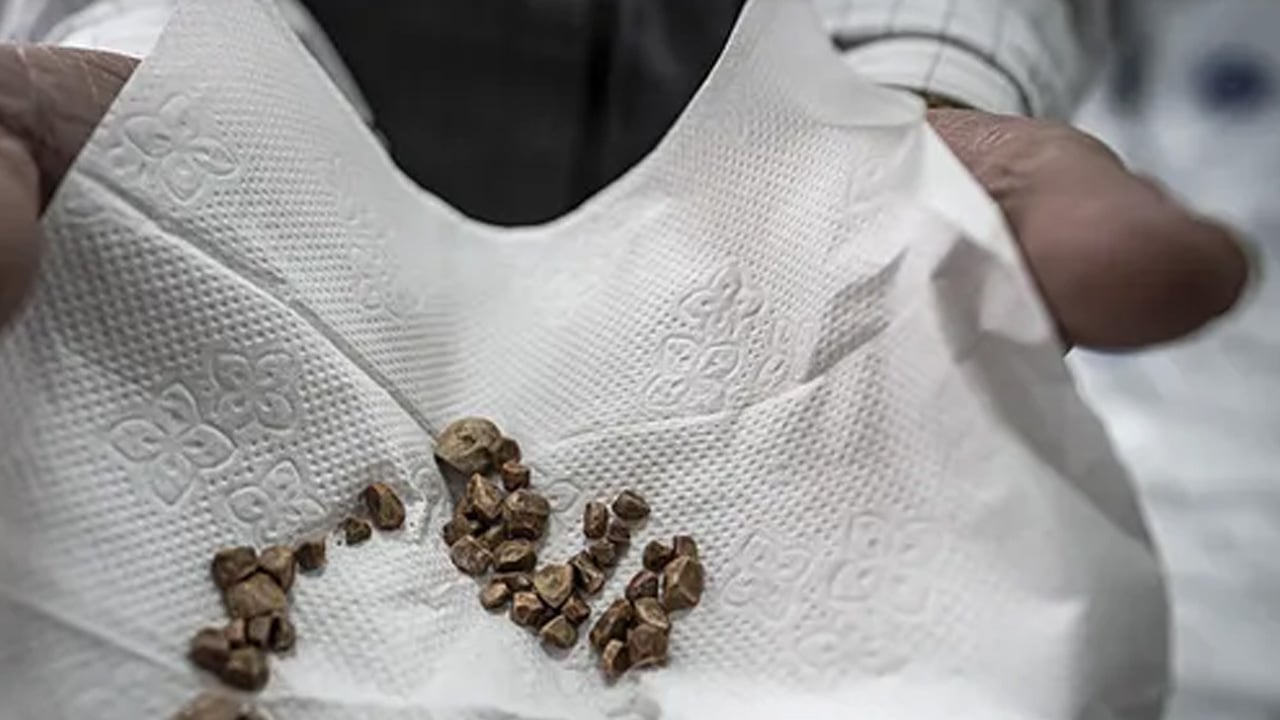 Foto - Doktorlar bile şoke oldu: Böbrek taşı yapıyormuş! Bu hali adeta zehir saçıyor