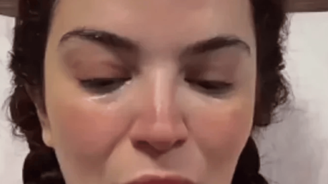 Foto - Doktorlar çaresiz kaldı! Ünlü oyuncu gözyaşları içinde açıkladı!