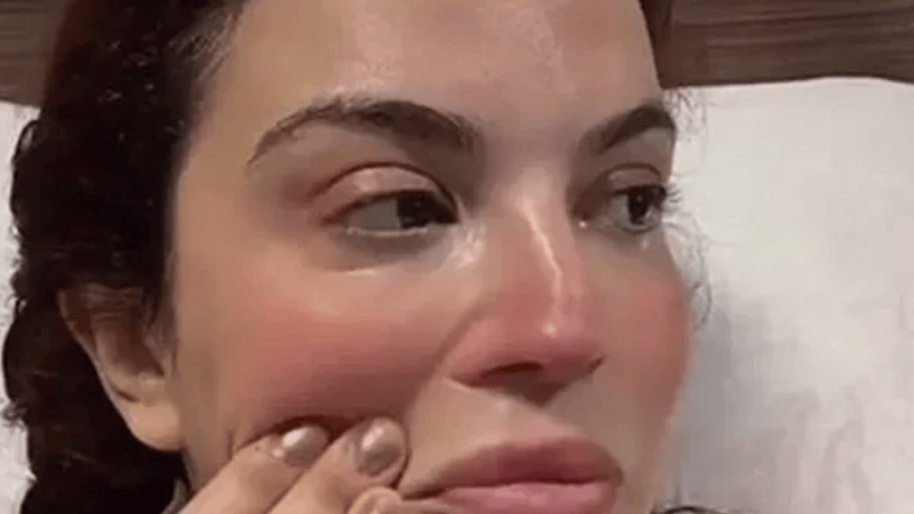 Foto - Doktorlar çaresiz kaldı! Ünlü oyuncu gözyaşları içinde açıkladı!