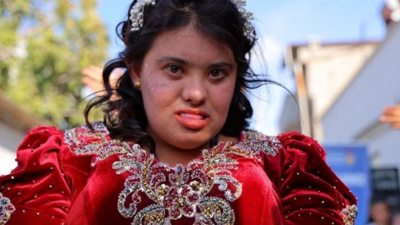 Foto - Down sendromlu Melek’in dileği gerçekleşti