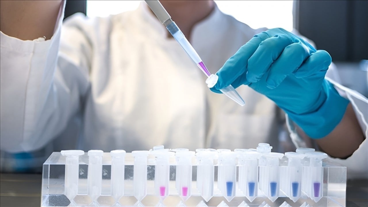 DSÖ açıkladı: 1,3 milyon kişi AIDS hastalığına yakalandı