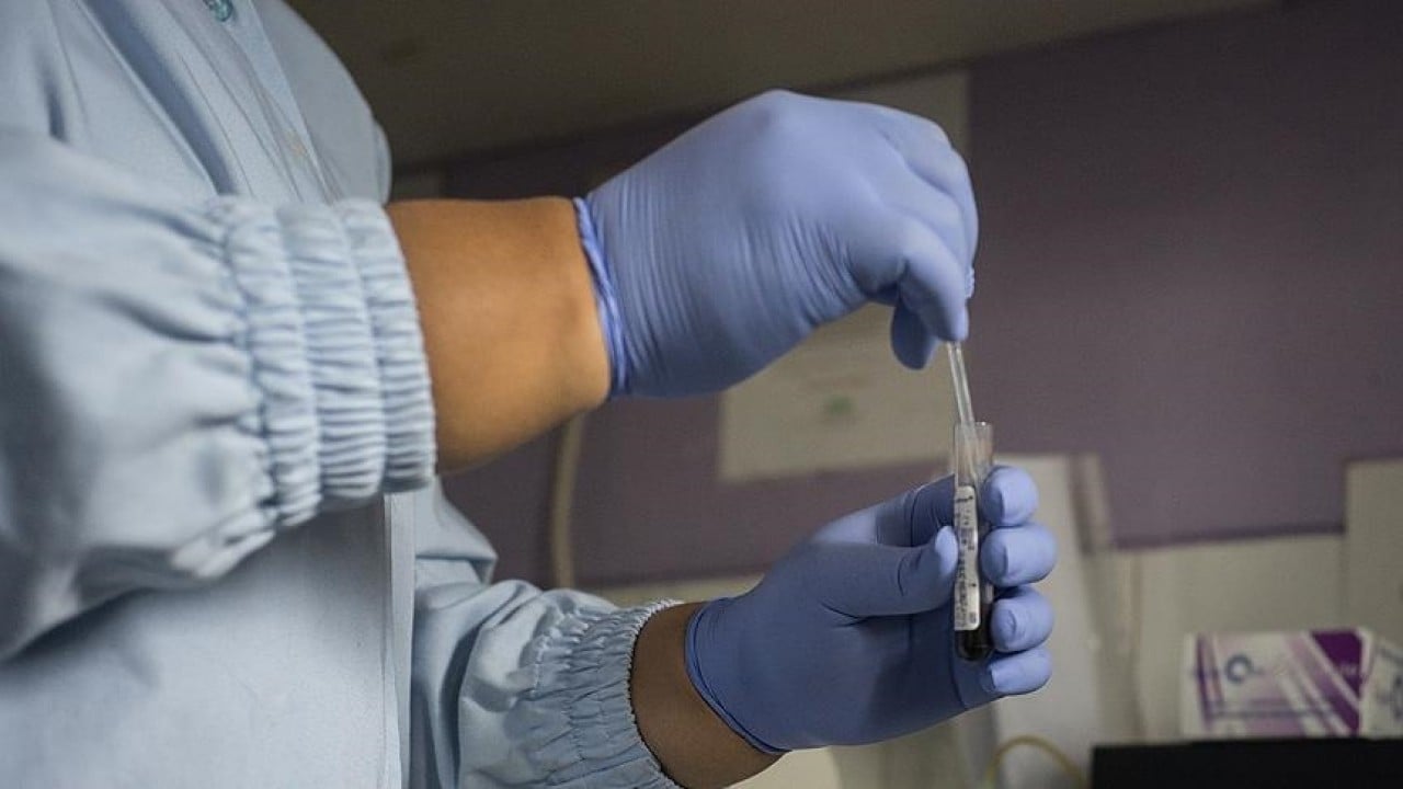 Foto - DSÖ açıkladı: 1,3 milyon kişi AIDS hastalığına yakalandı