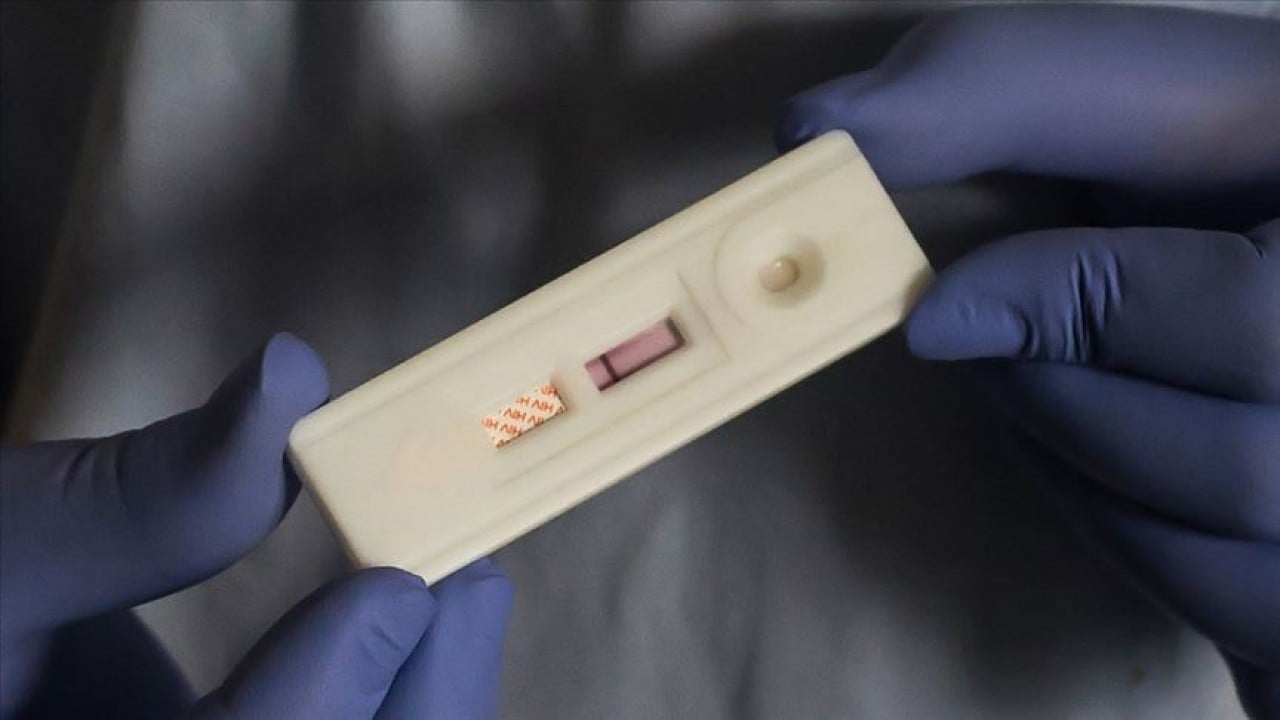 Foto - DSÖ açıkladı: 1,3 milyon kişi AIDS hastalığına yakalandı