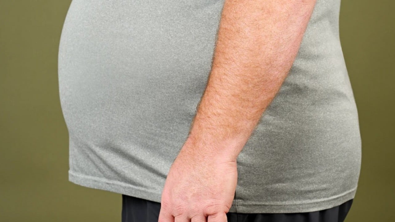 Foto - DSÖ açıkladı: Dünyada her 8 kişiden 1'i obez