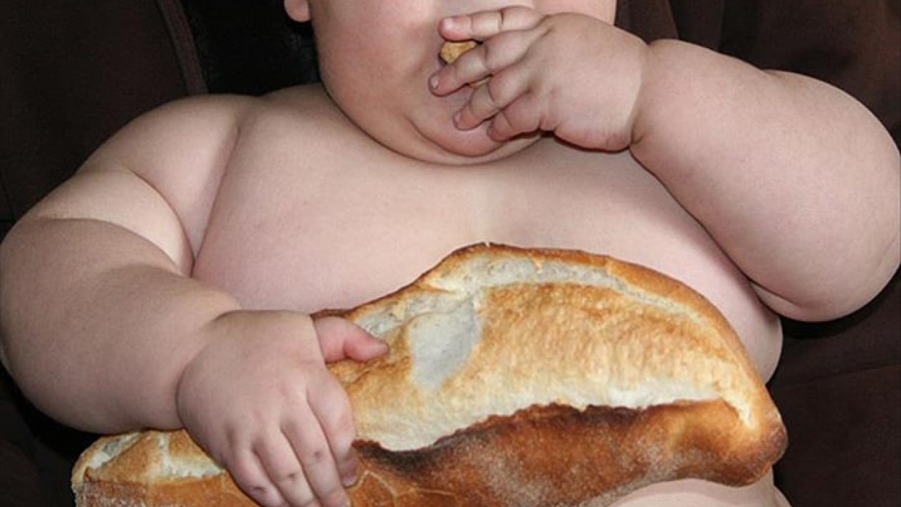 Foto - DSÖ açıkladı: Dünyada her 8 kişiden 1'i obez