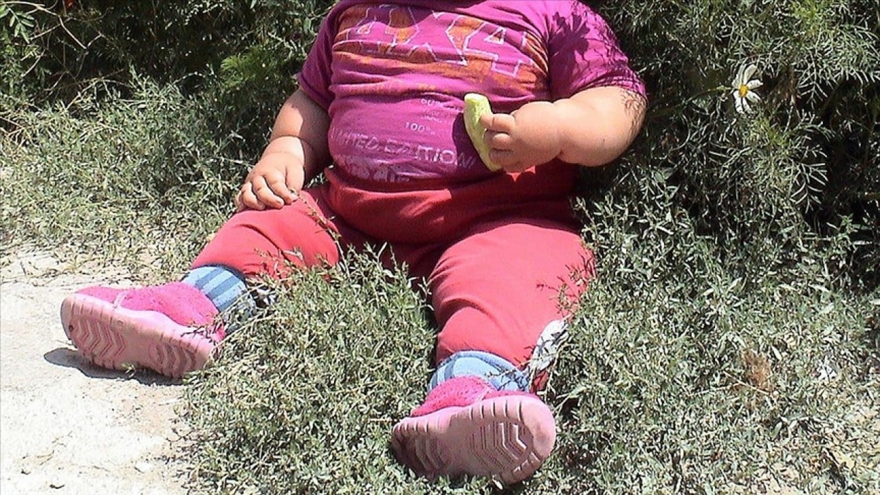 Foto - DSÖ açıkladı: Dünyada her 8 kişiden 1'i obez