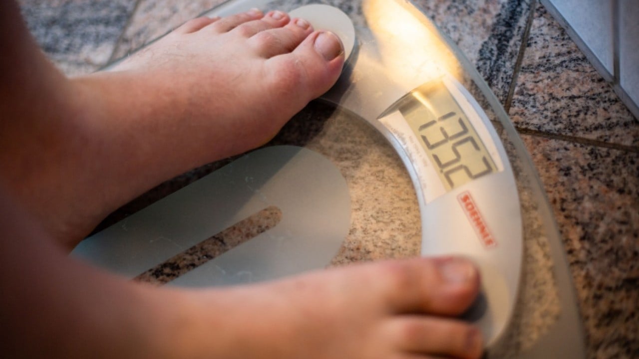 Foto - DSÖ açıkladı: Dünyada her 8 kişiden 1'i obez