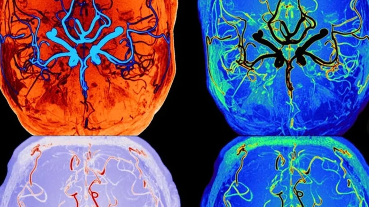 Foto - Dünya genelinde çok konuşuluyordu: Uyurken beyin bizimle konuşuyor mu? Sıra dışı olay: Siz de ciddiye alın