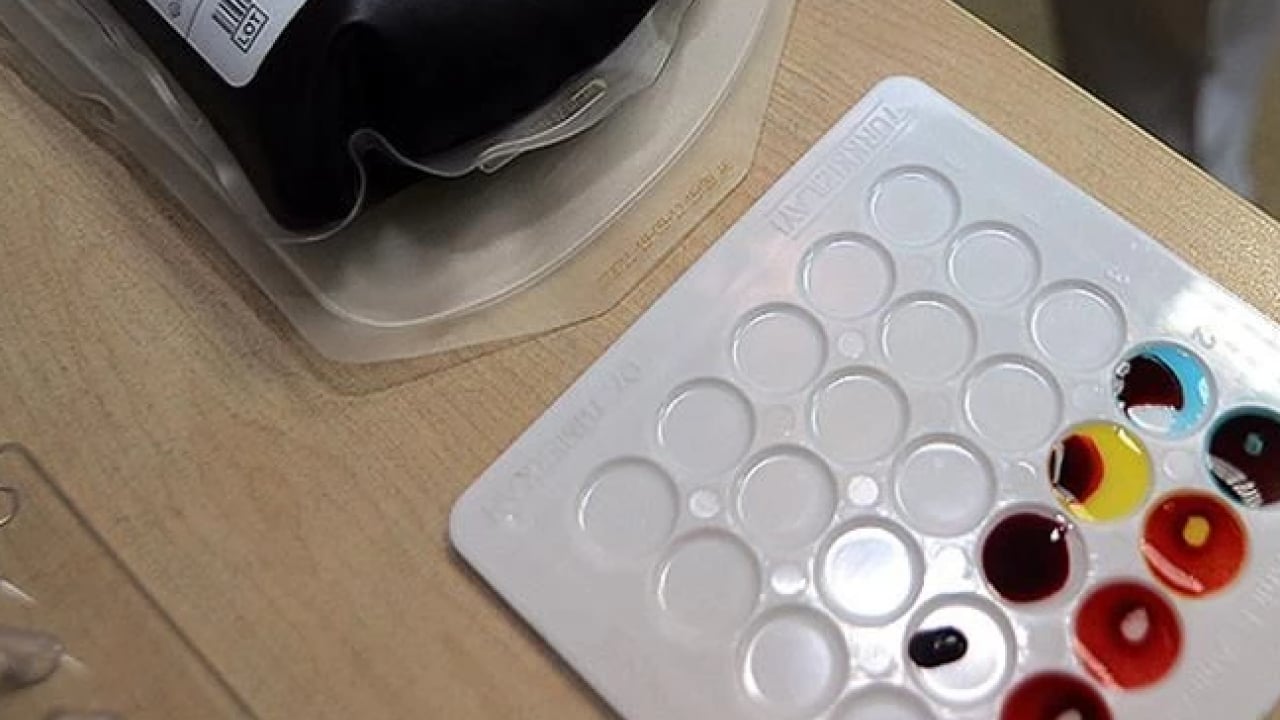 Foto - Dünyada sayılı insan bu kana sahip! ‘Altın kan'ın bir damlası servet değerinde