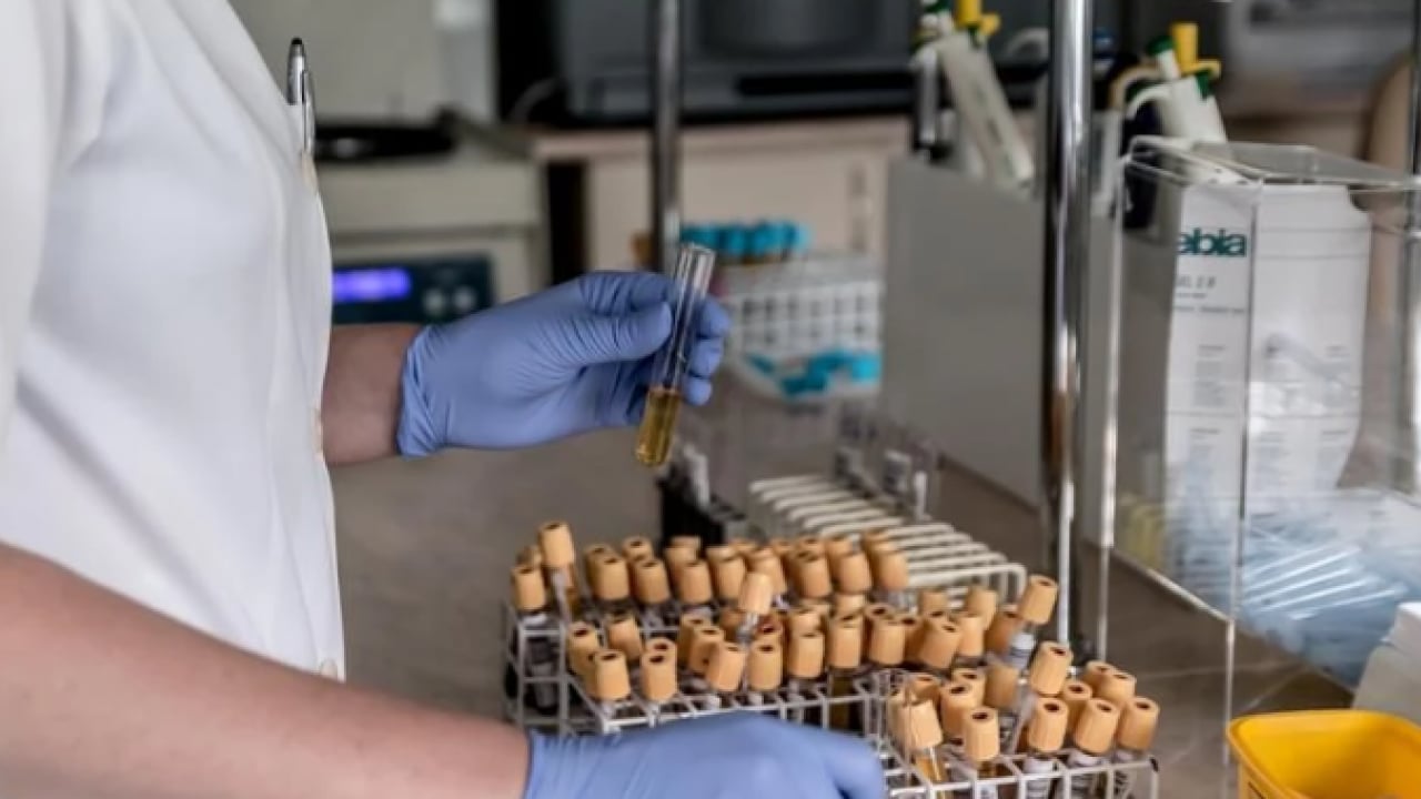 Foto - Dünyada sayılı insan bu kana sahip! ‘Altın kan'ın bir damlası servet değerinde