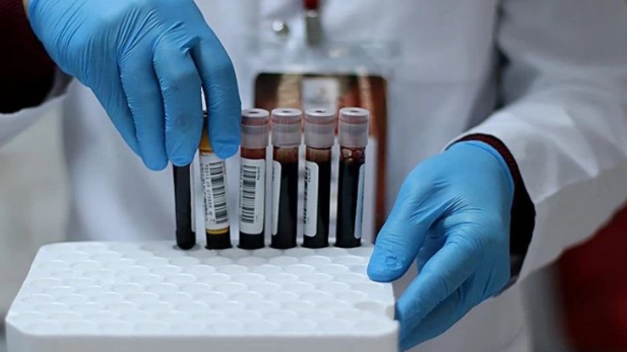 Foto - Dünyada sayılı insan bu kana sahip! ‘Altın kan'ın bir damlası servet değerinde