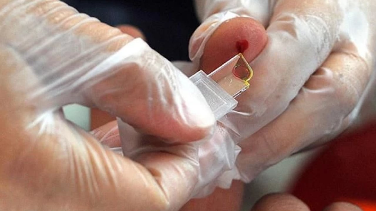 Foto - Dünyada sayılı insan bu kana sahip! ‘Altın kan'ın bir damlası servet değerinde