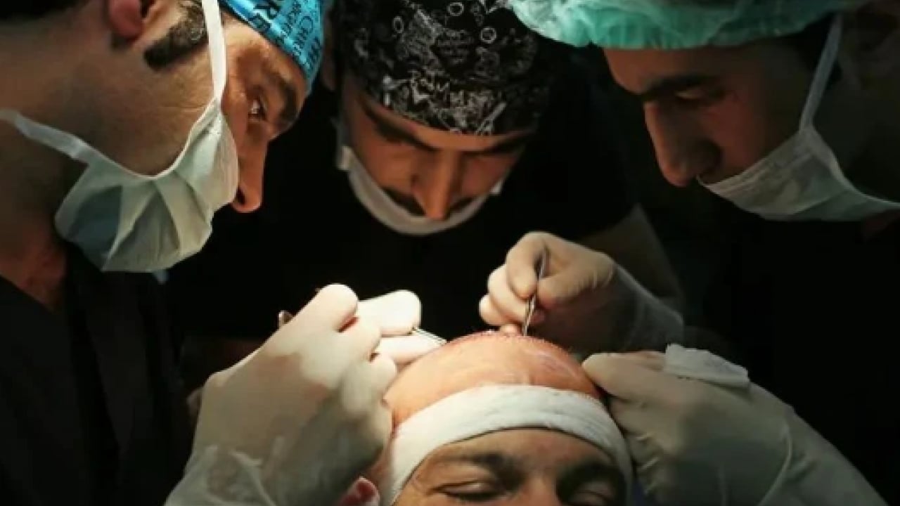 Foto - Dünyanın kellik haritasi belli oldu! Türkiye'de kaç tane kel var!
