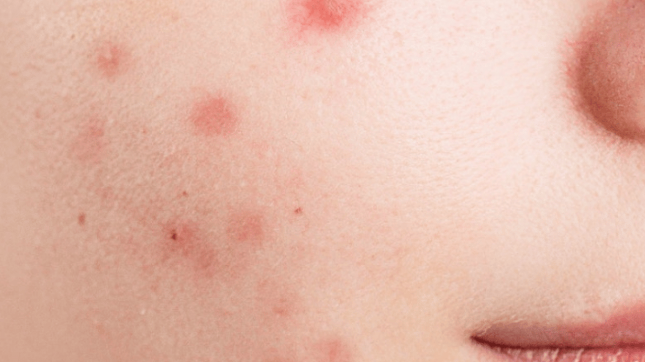 Foto - Dünyaya duyurdular: Kırmızı alarmın görünmeyen yüzü ortaya çıktı...