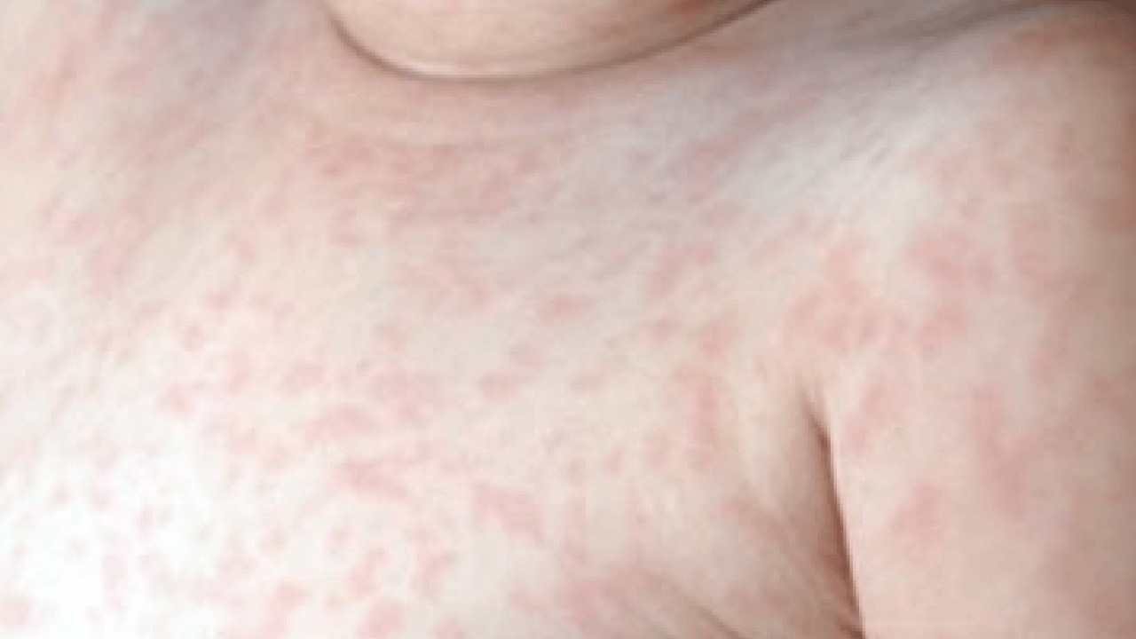 Foto - Dünyaya duyurdular: Kırmızı alarmın görünmeyen yüzü ortaya çıktı...