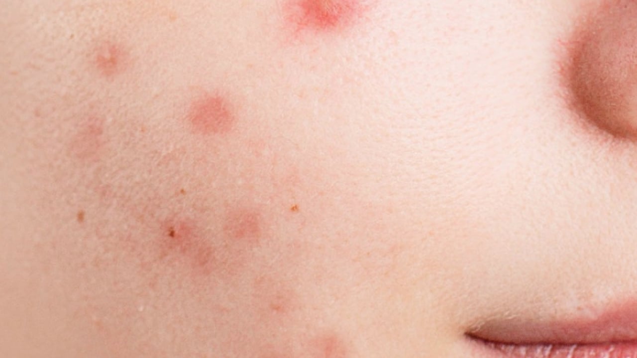 Foto - Dünyaya duyurdular: Kırmızı alarmın görünmeyen yüzü ortaya çıktı...