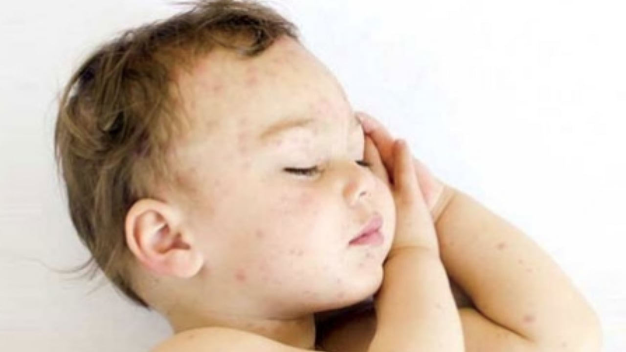 Foto - Dünyaya duyurdular: Kırmızı alarmın görünmeyen yüzü ortaya çıktı...