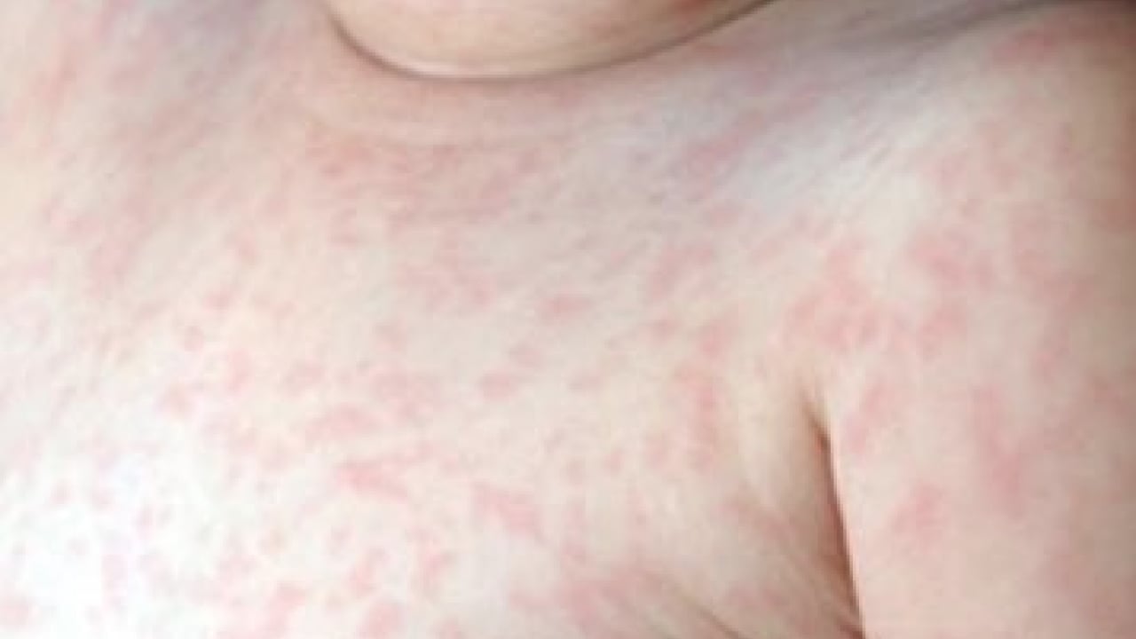 Foto - Dünyaya duyurdular: Kırmızı alarmın görünmeyen yüzü ortaya çıktı...