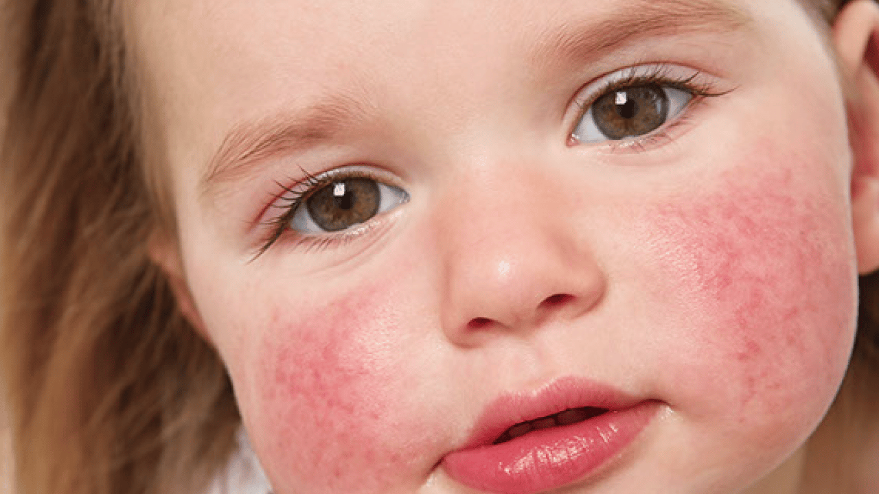 Foto - Dünyaya duyurdular: Kırmızı alarmın görünmeyen yüzü ortaya çıktı...