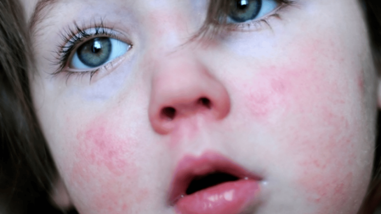 Dünyaya duyurdular: Kırmızı alarmın görünmeyen yüzü ortaya çıktı...