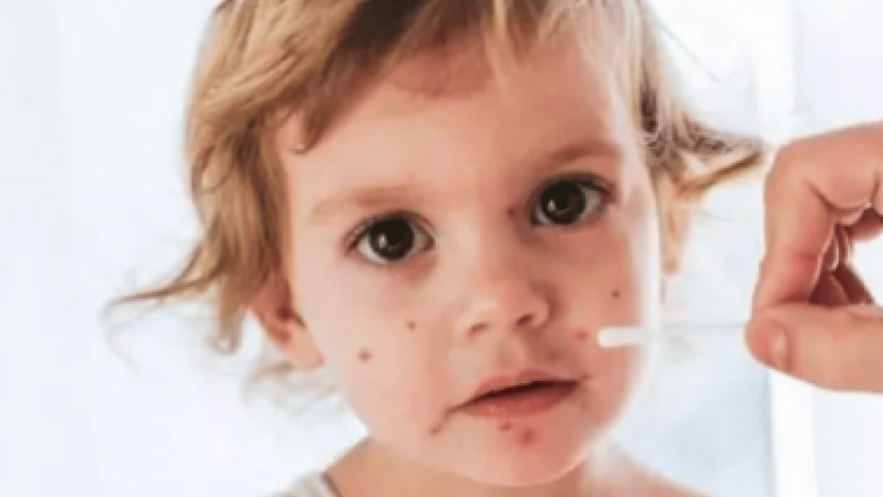 Foto - Dünyaya duyurdular: Kırmızı alarmın görünmeyen yüzü ortaya çıktı...