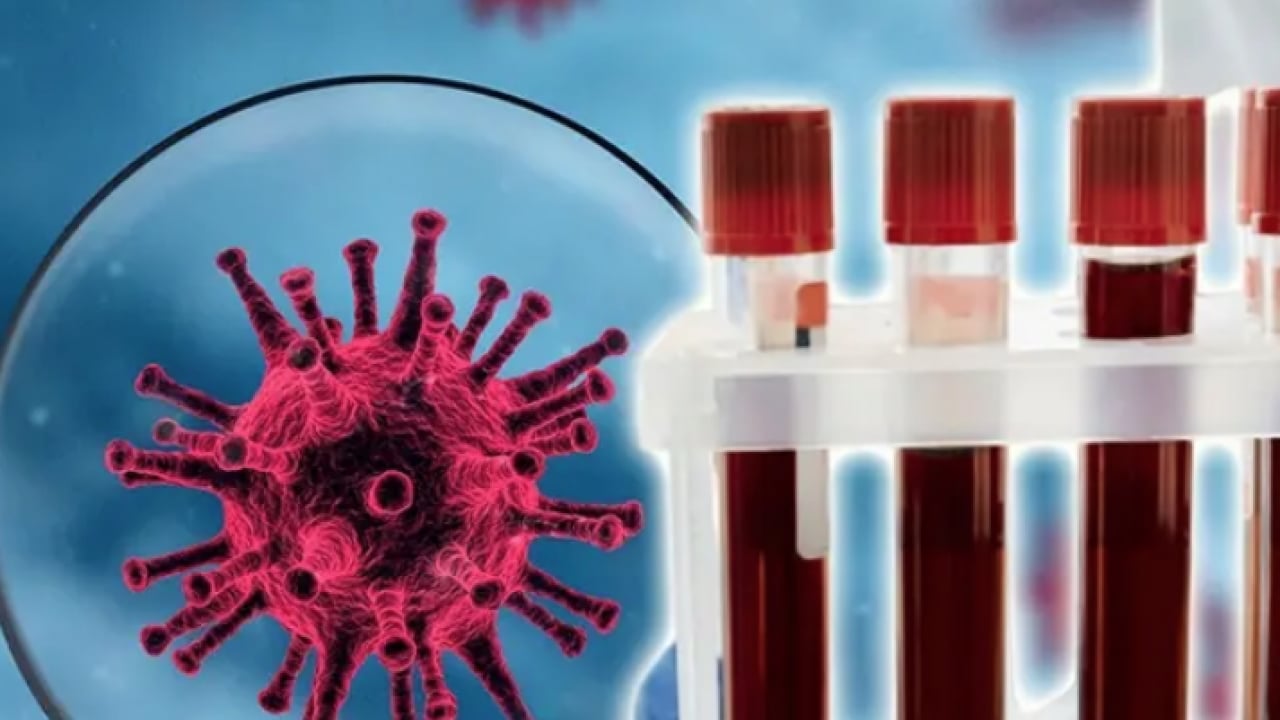 Foto - Düşük kalp hastalığı... Kalbi en kuvvetli kan grubu! Onlar kardiyoloğa uğramıyor