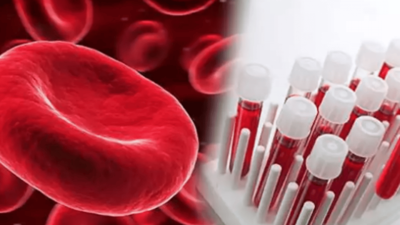 Foto - Düşük kalp hastalığı... Kalbi en kuvvetli kan grubu! Onlar kardiyoloğa uğramıyor