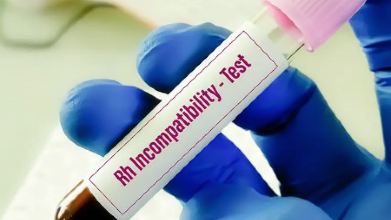 Foto - Düşük kalp hastalığı... Kalbi en kuvvetli kan grubu! Onlar kardiyoloğa uğramıyor