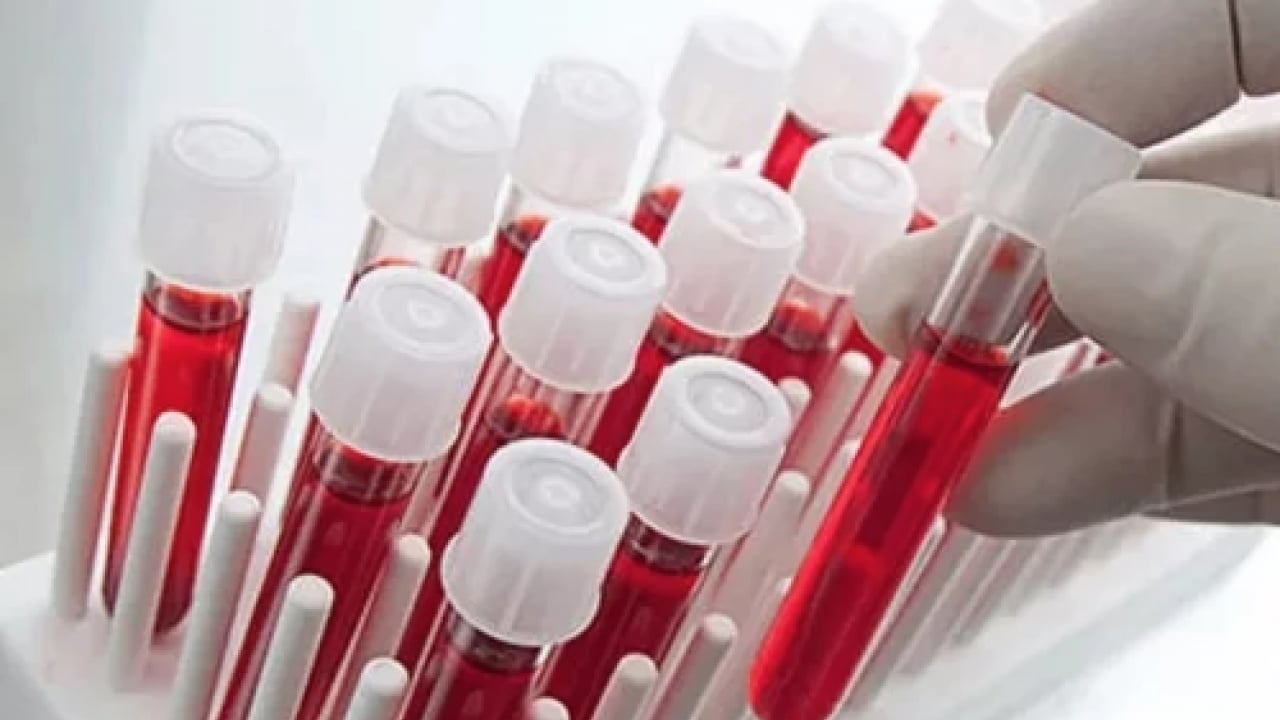 Foto - Düşük kalp hastalığı... Kalbi en kuvvetli kan grubu! Onlar kardiyoloğa uğramıyor