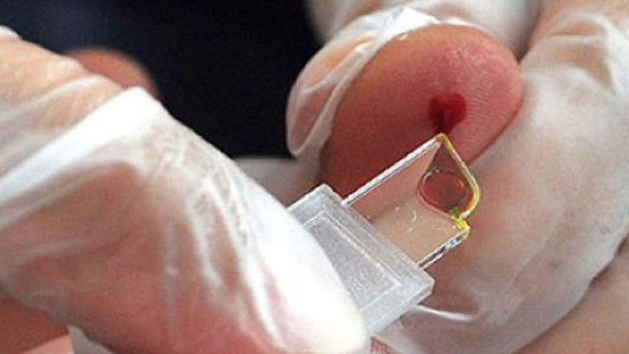 Foto - Düşük kalp hastalığı... Kalbi en kuvvetli kan grubu! Onlar kardiyoloğa uğramıyor