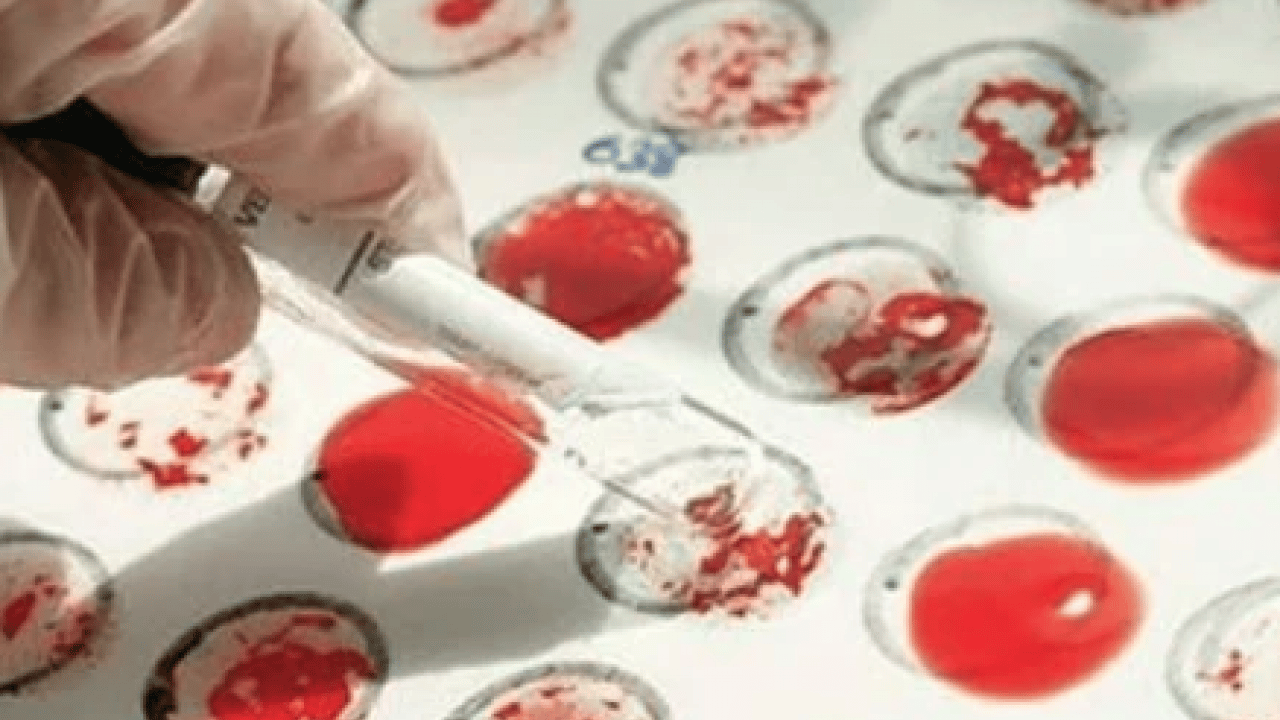 Foto - Düşük kalp hastalığı... Kalbi en kuvvetli kan grubu! Onlar kardiyoloğa uğramıyor