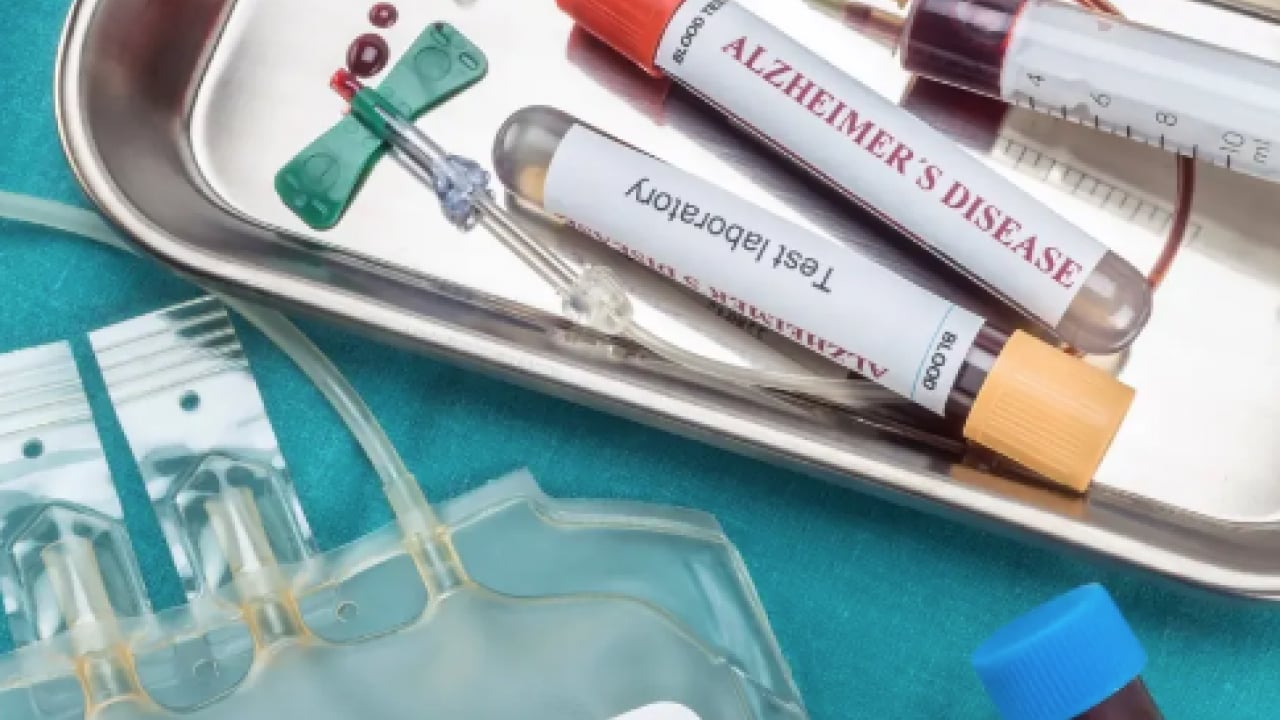 Foto - Düşük kalp hastalığı... Kalbi en kuvvetli kan grubu! Onlar kardiyoloğa uğramıyor