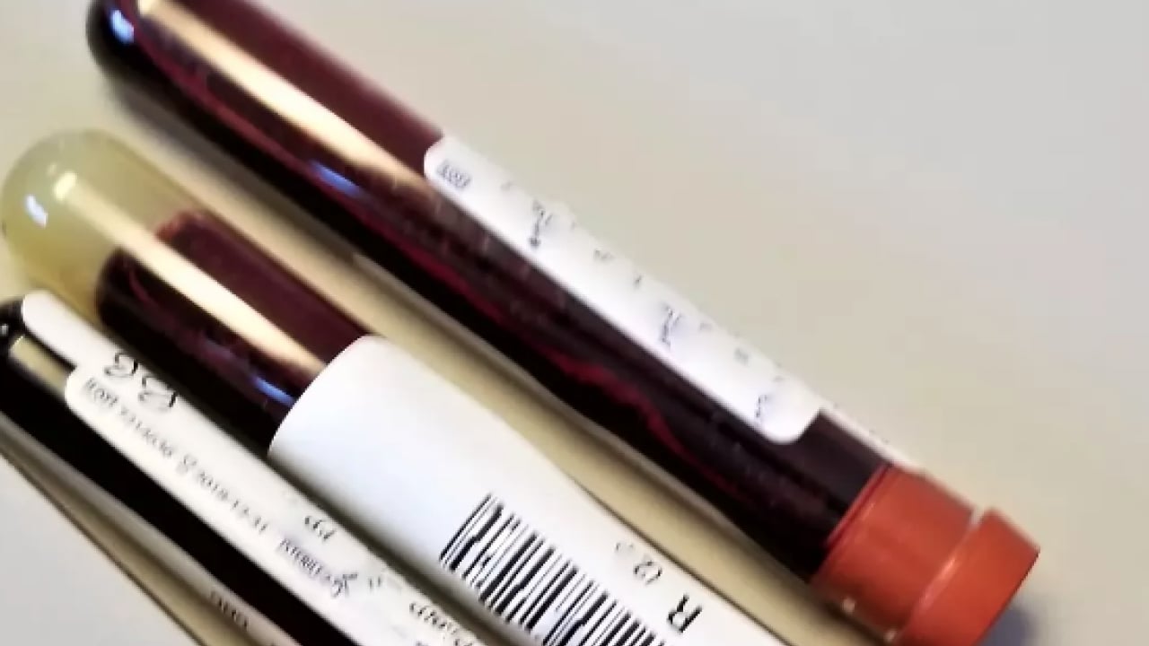 Foto - Düşük kalp hastalığı... Kalbi en kuvvetli kan grubu! Onlar kardiyoloğa uğramıyor